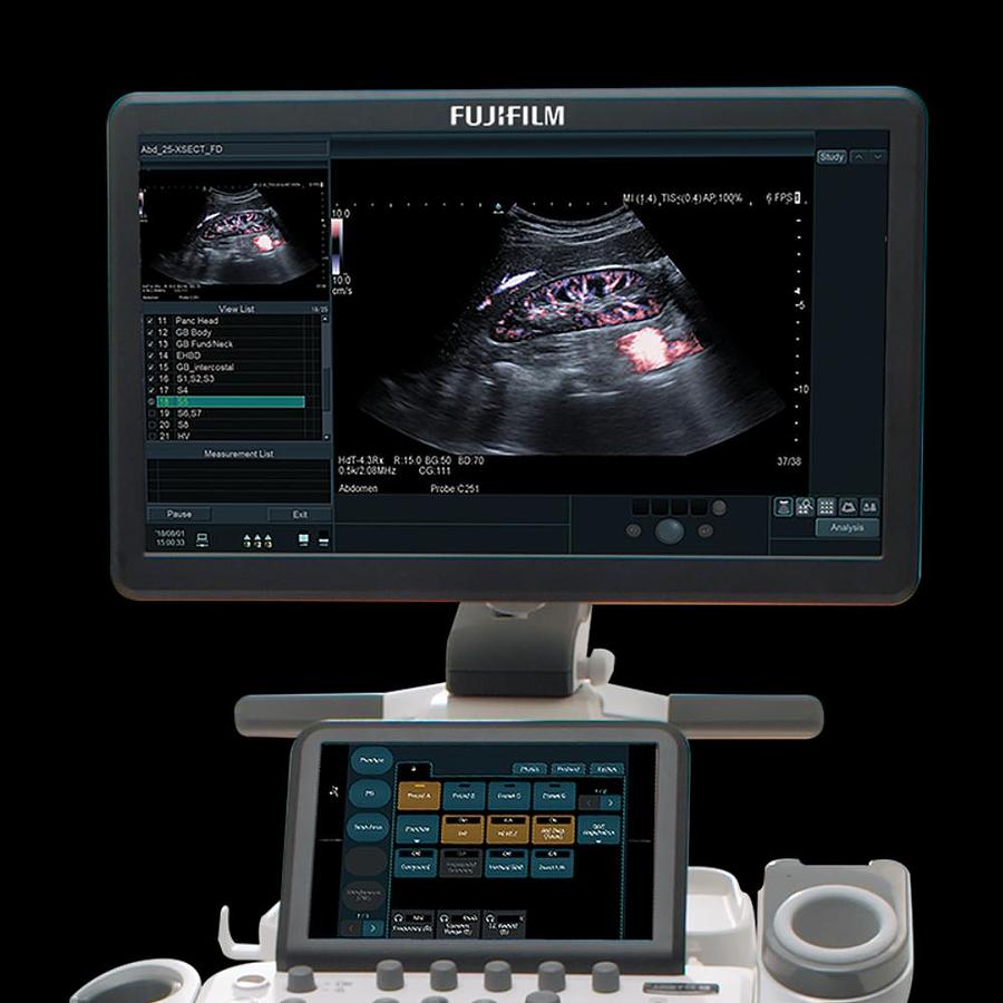2025 FujiFilm Arrietta 65