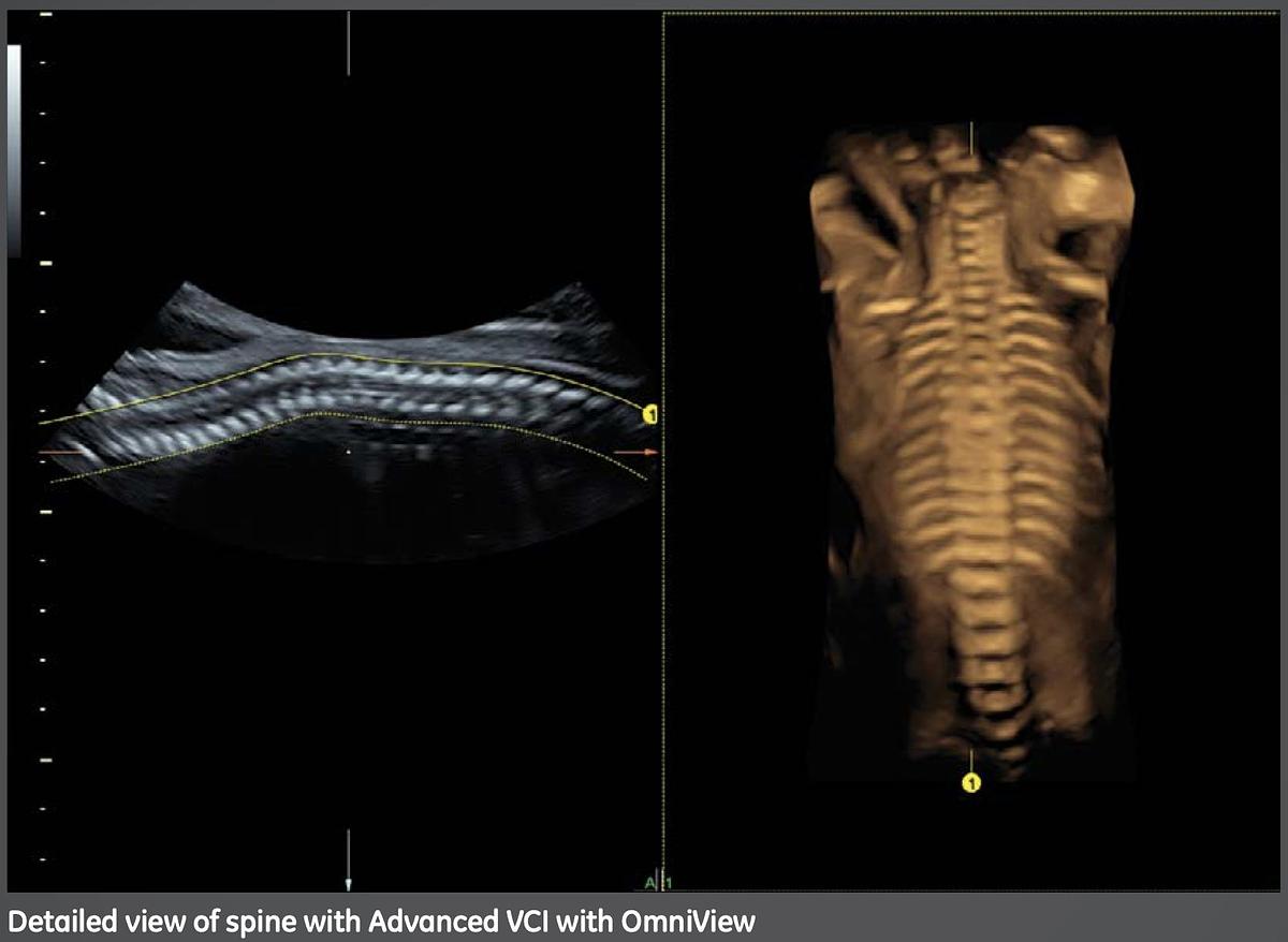 Used 2014 General Electric (GE) Voluson S8