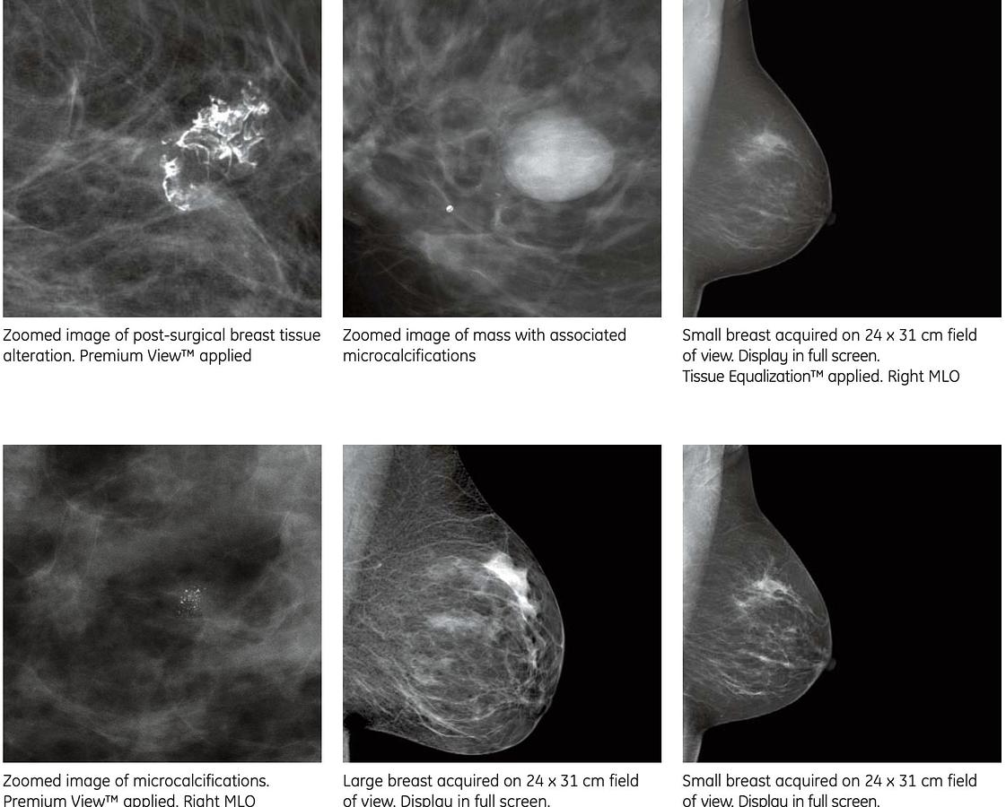 Usado Mastógrafo Digital GE Essential Senographe