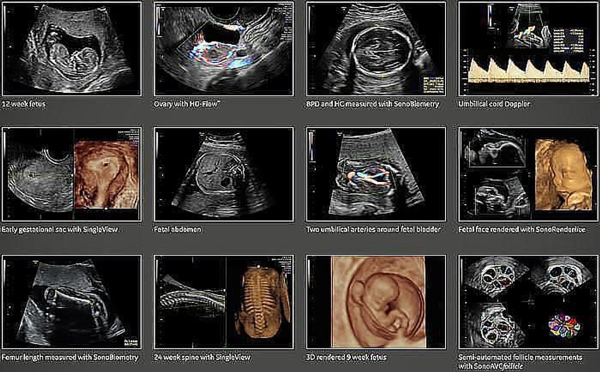 Reformado Ultrasonido General Electric (GE) Voluson P8 BT22