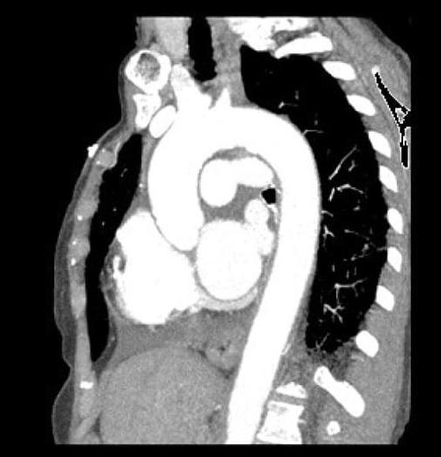 Usado 2017 General Electric (GE) Revolution EVO