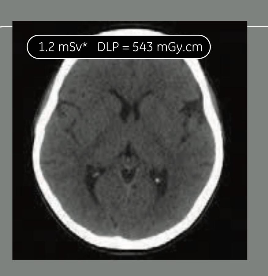 Reformado Tomografo General Electric Optima 660 de 64 cortes