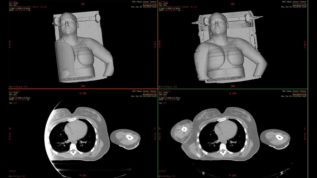 Refurbished Tomografo General Electric (GE) Discovery CT590 RT