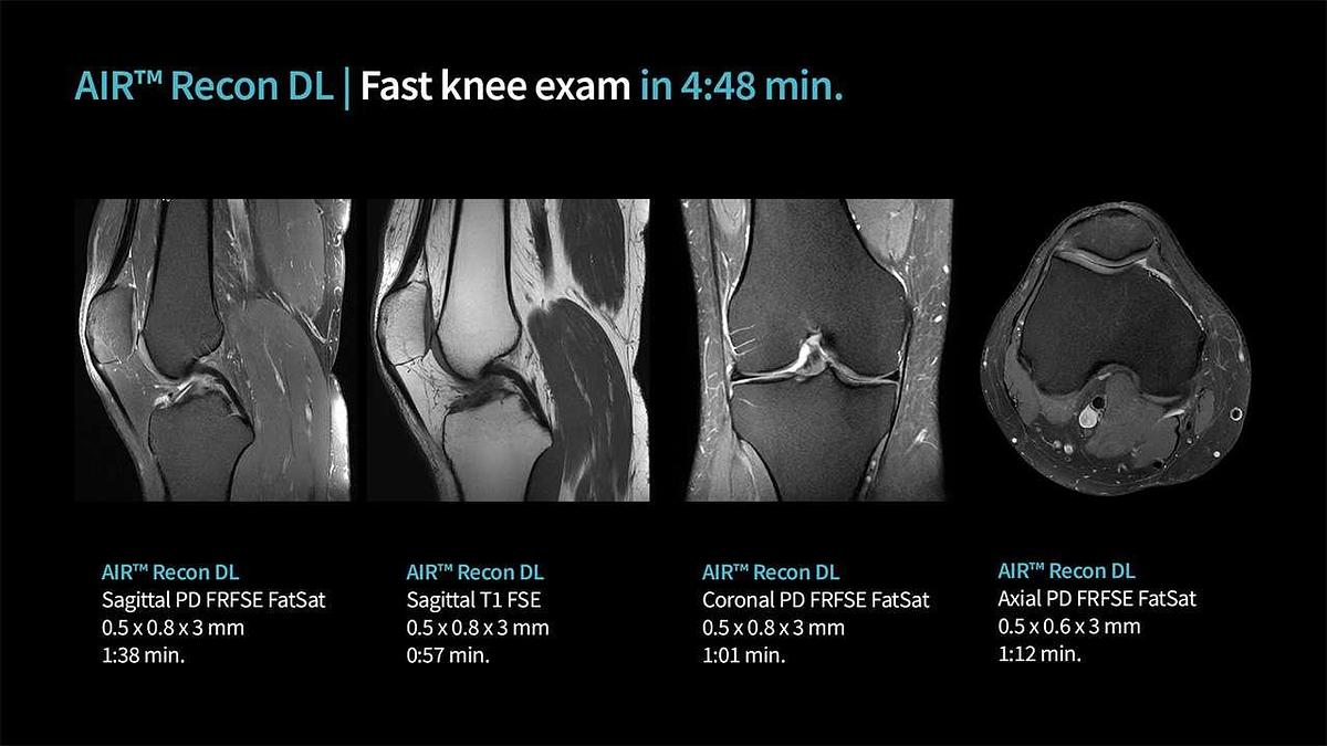 Refurbished 2019 General Electric (GE) Signa Explorer 1.5T