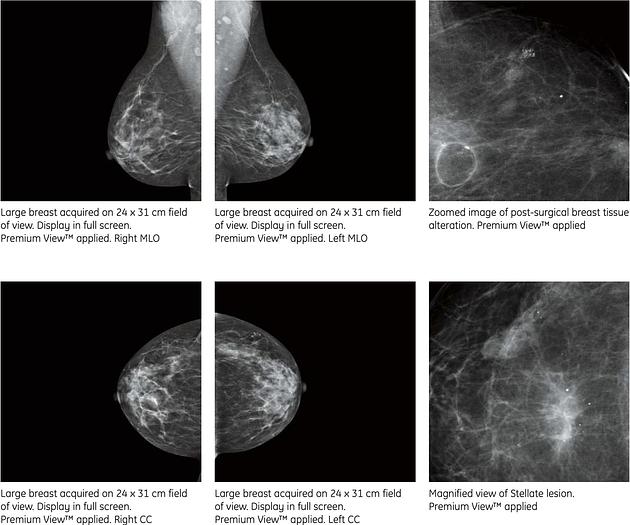 Used Mastógrafo  Digital GE Essential