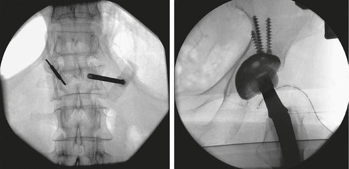 Usado 2017 Siemens Arcadis Orbic 3D