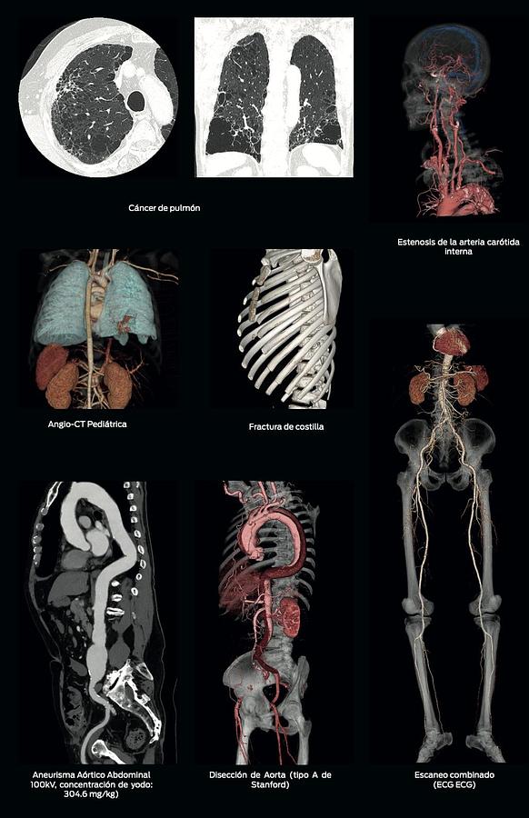 Used Tomógrafo Nuevo FujiFilm Scenaria 64 Cortes