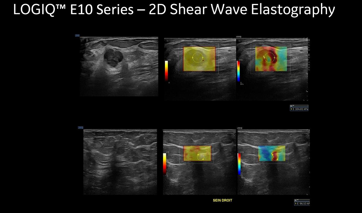 Refurbished 2025 General Electric (GE) LOGIQ E10