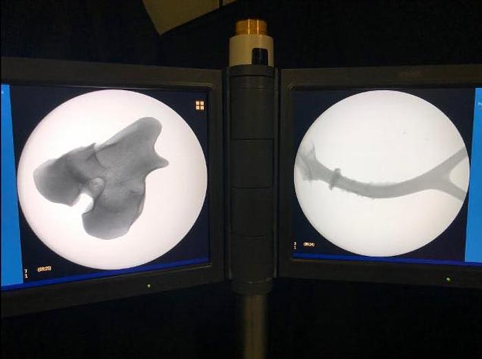 Refurbished Arco en C PHILIPS PULSERA