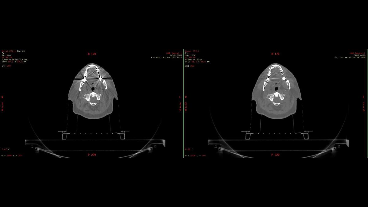 Refurbished Tomografo General Electric (GE) Discovery CT590 RT