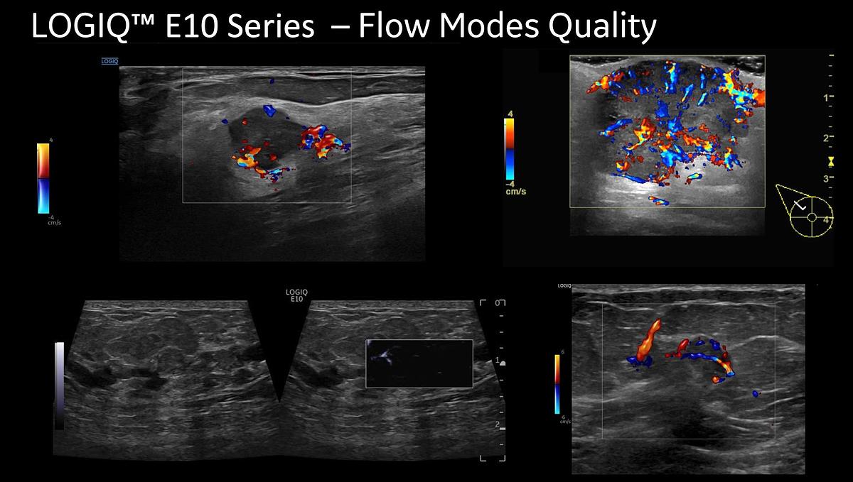 Reformado Ultrasonido General Electric (GE) LOGIQ E10