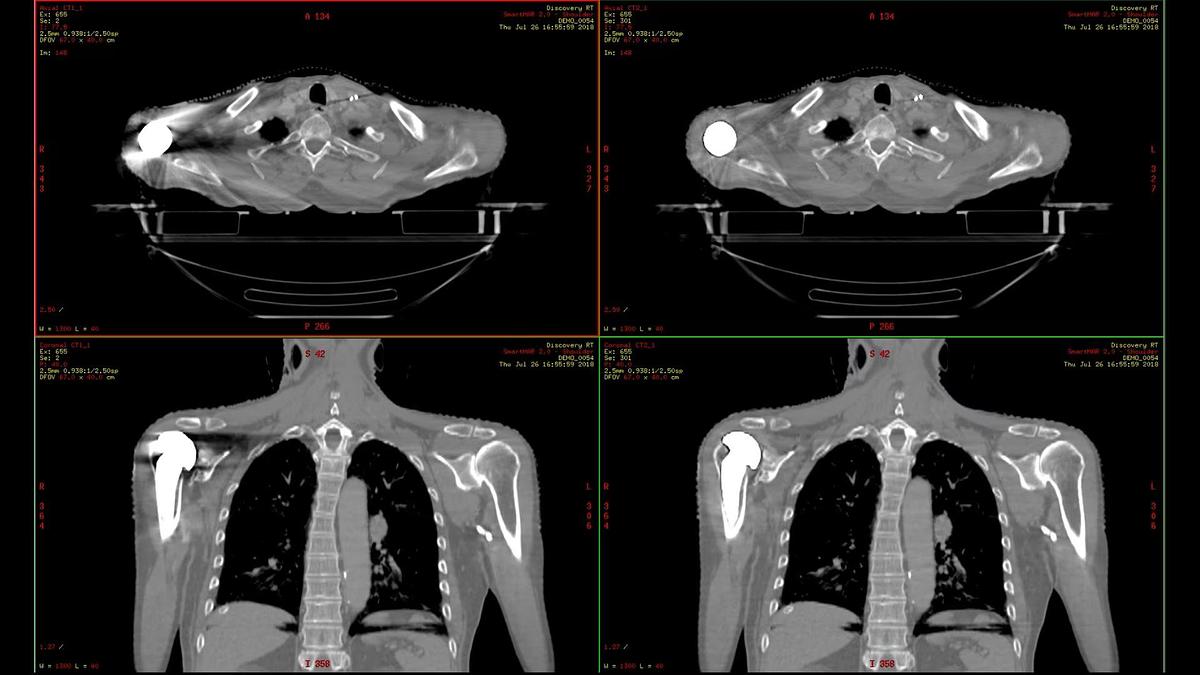Refurbished Tomografo General Electric (GE) Discovery CT590 RT