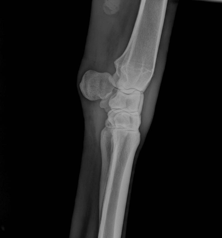 2024 PIXXGEN PRUDENT 1212