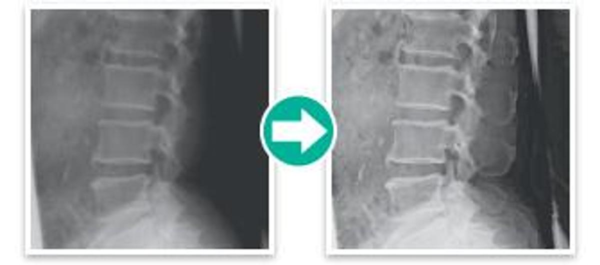 2020 FujiFilm FCR PRIMA T2