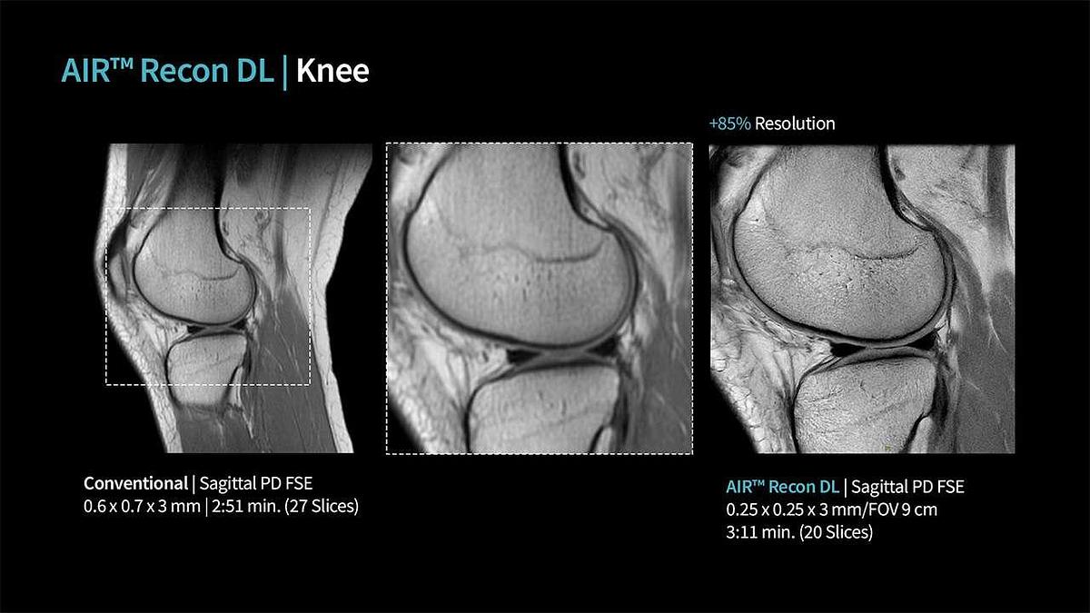 Refurbished 2019 General Electric (GE) Signa Explorer 1.5T