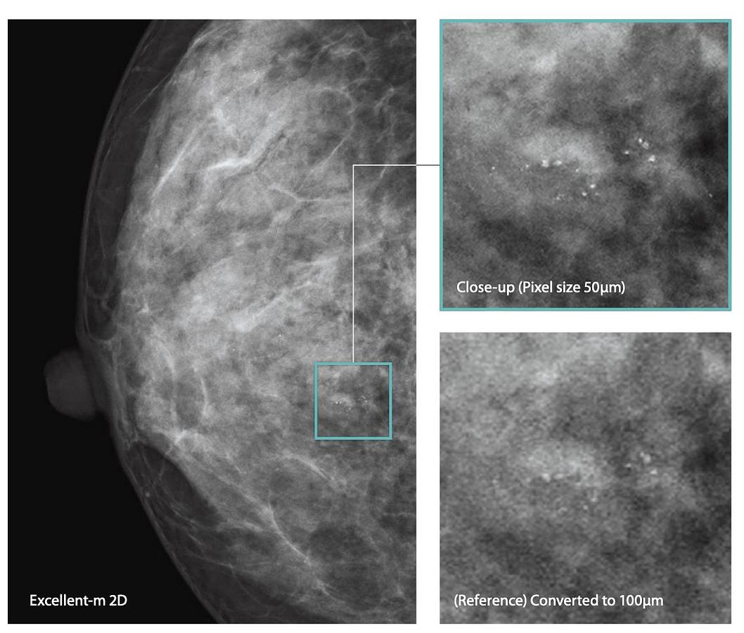 2025 FujiFilm Amulet Innovality Tomosynthesis