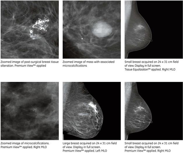 Used Mastógrafo Digital GE Essential