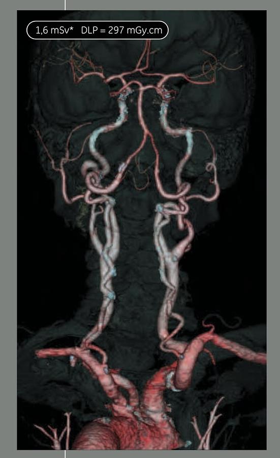 Reformado Tomografo General Electric Optima 660 de 64 cortes