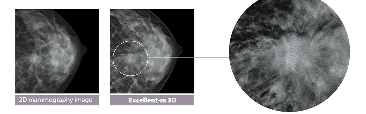 2025 FujiFilm Amulet Innovality Tomosynthesis