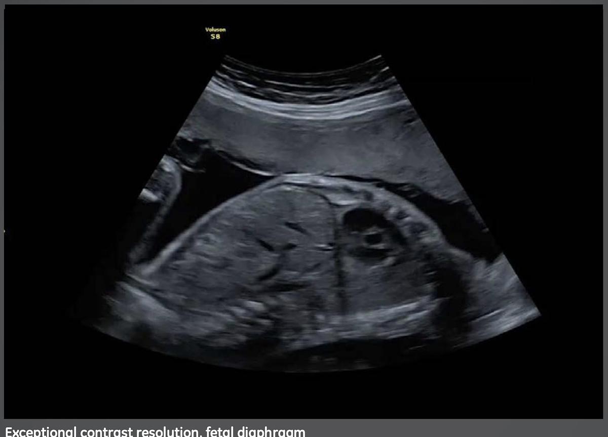 Used 2014 General Electric (GE) Voluson S8