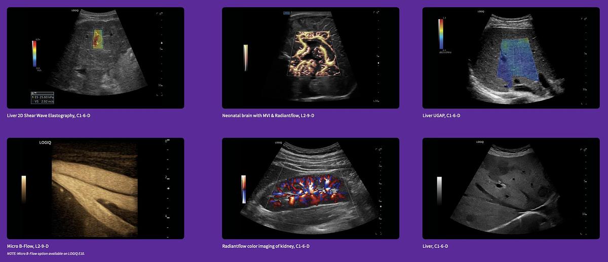 Refurbished 2025 General Electric (GE) LOGIQ E10