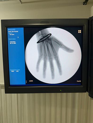 Used 2011 PHILIPS Veradius Neo