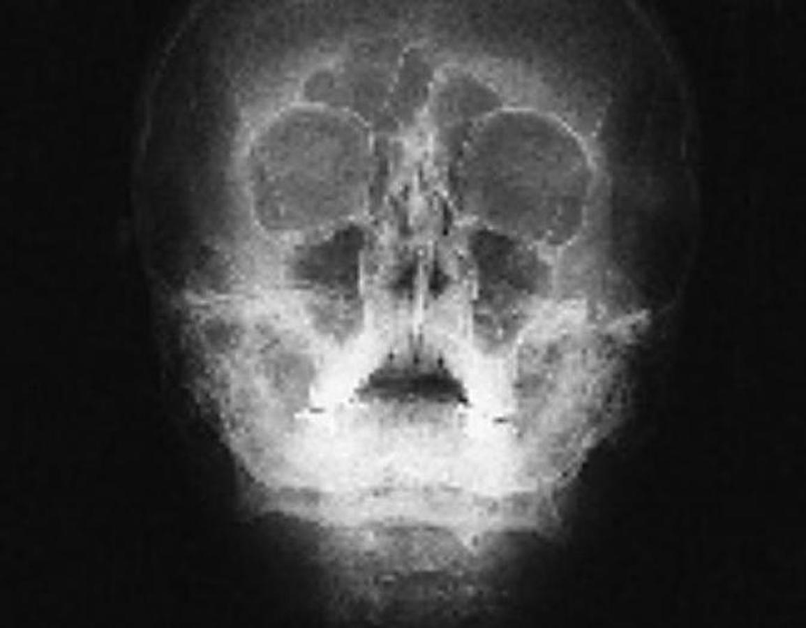 Usado 2001 General Electric (GE) Proteus Xr/a