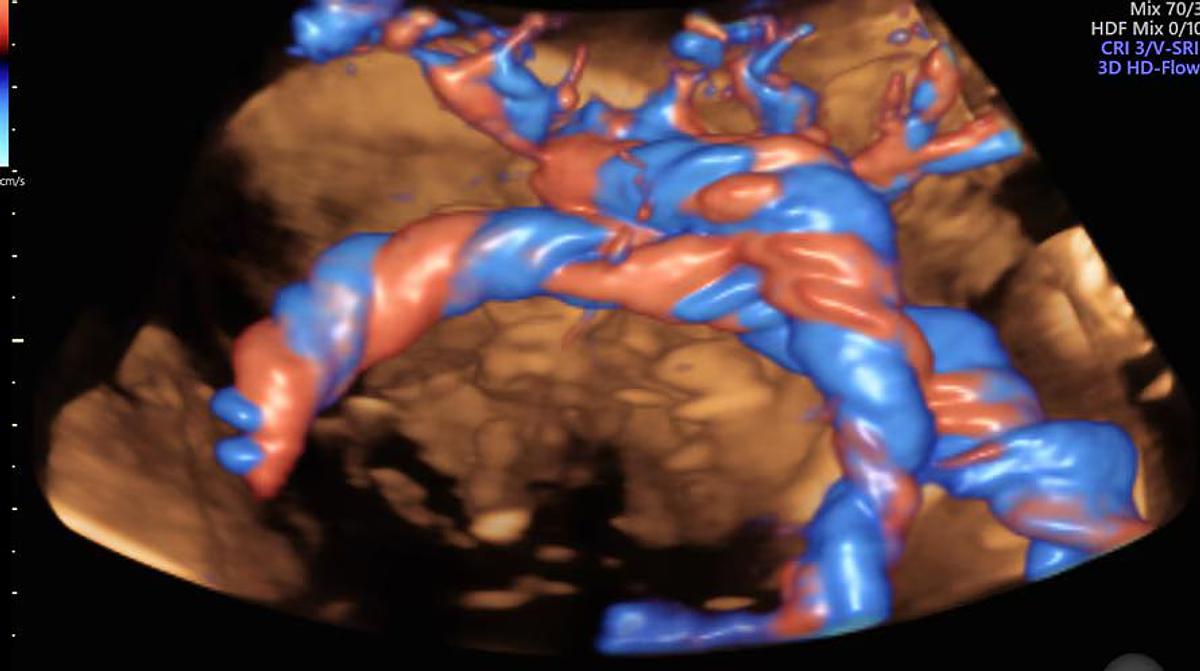 Refurbished 2026 General Electric (GE) Voluson E8