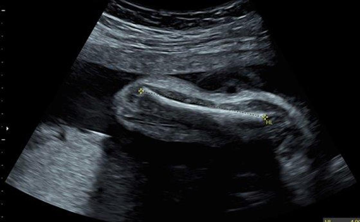 Reformado Ultrasonido GE Voluson S6 BT12