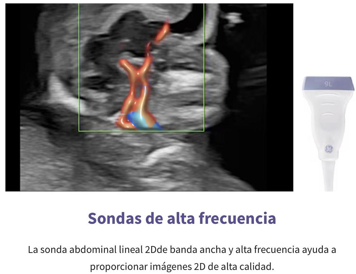 Refurbished Ultrasonido General Electric (GE) Voluson E8