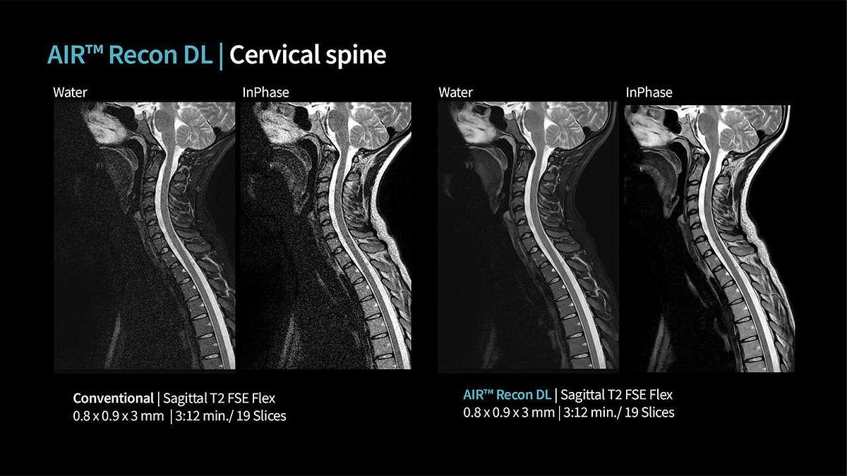 Refurbished 2019 General Electric (GE) Signa Explorer 1.5T