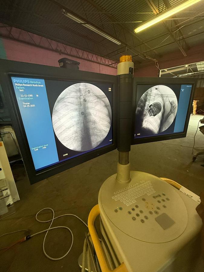 Used 2011 PHILIPS Veradius