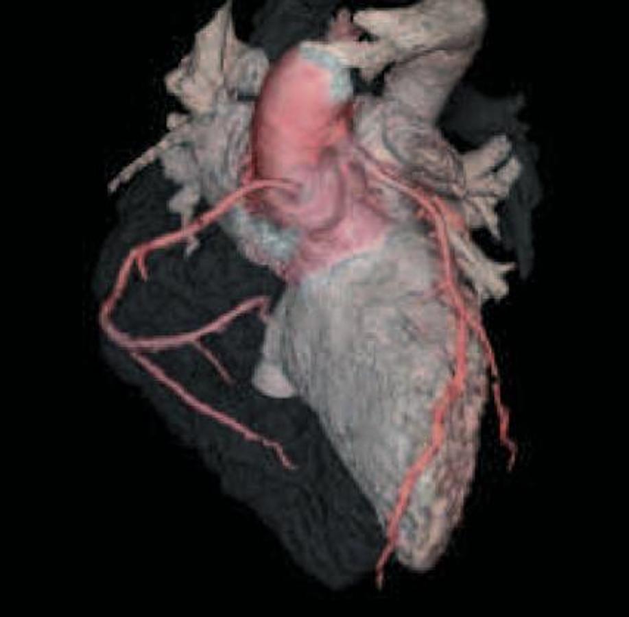 Refurbished General Electric (GE) LightSpeed VCT