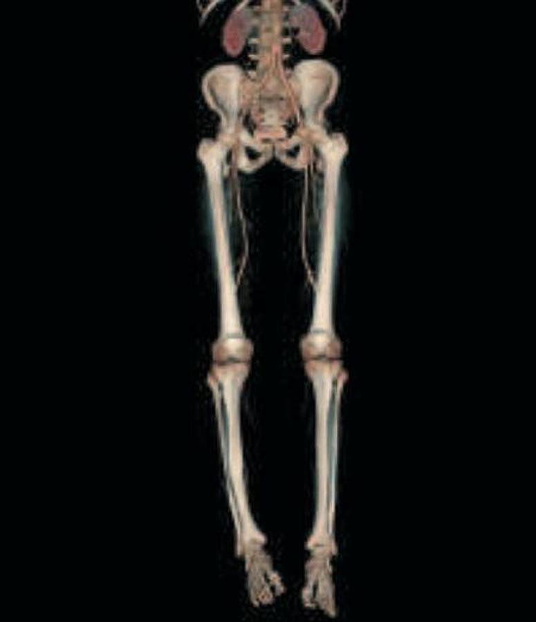 Refurbished General Electric (GE) LightSpeed VCT