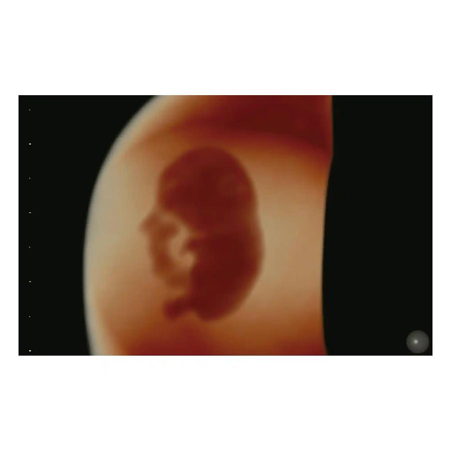 Used Ultrasonido General Electric (GE) Voluson S8