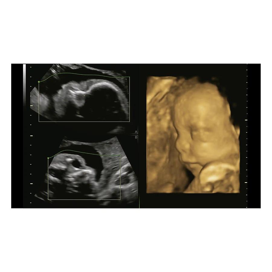 Used 2018 General Electric (GE) Voluson P8