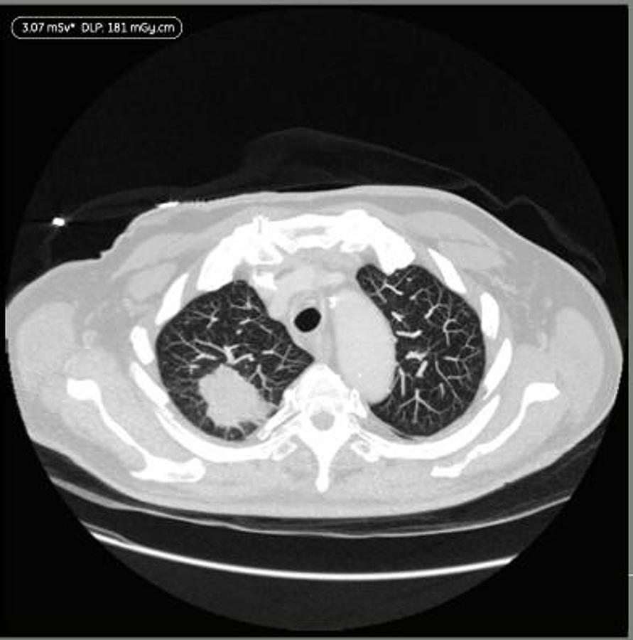 Refurbished Tomógrafo GE (General Electric) BrightSpeed Elite de 16 cortes