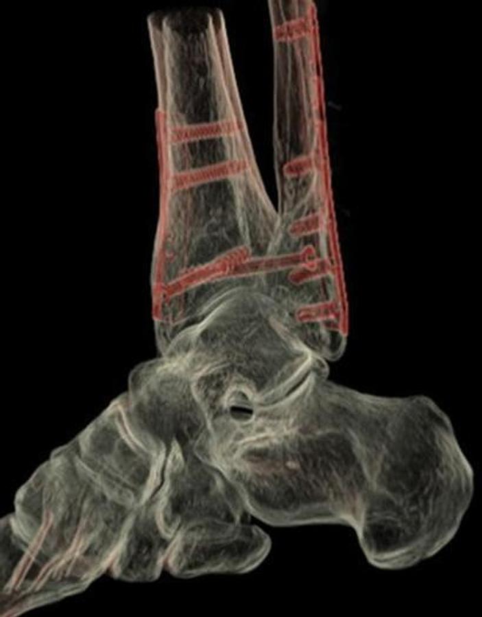 Usado 2017 General Electric (GE) Revolution EVO