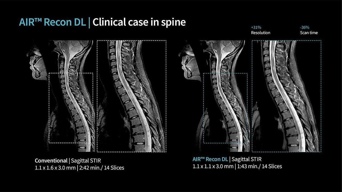 Refurbished 2019 General Electric (GE) Signa Explorer 1.5T