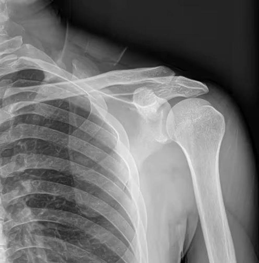 Flat Panel iRay Mars 1417V