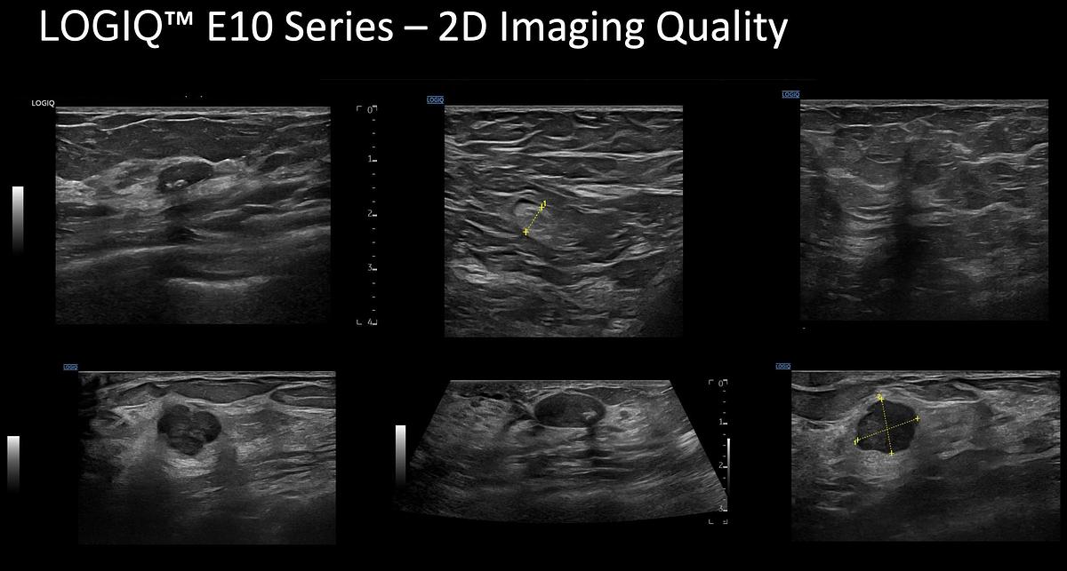 Reformado Ultrasonido General Electric (GE) LOGIQ E10
