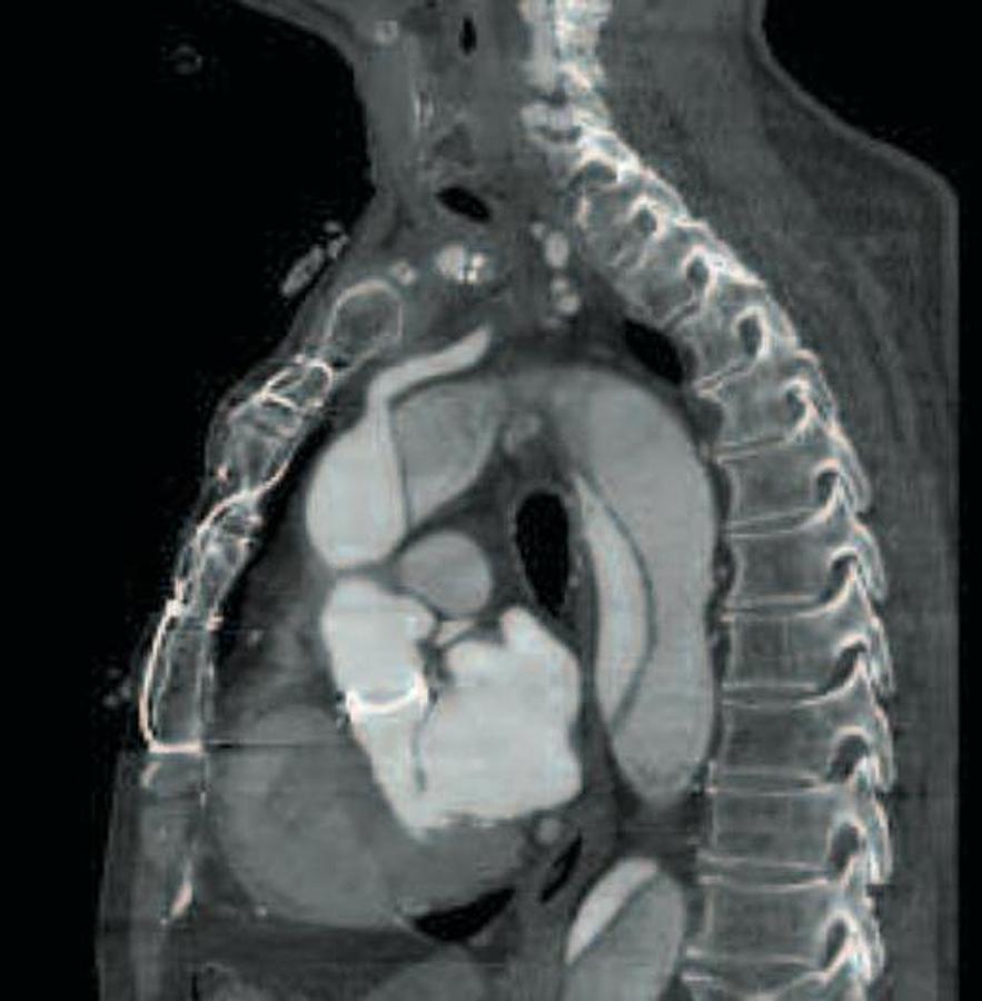 Refurbished General Electric (GE) LightSpeed VCT