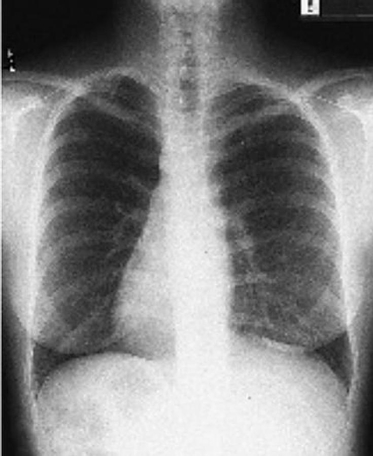 Usado 2001 General Electric (GE) Proteus Xr/a