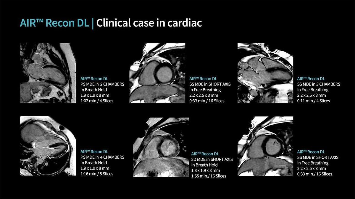 Refurbished 2019 General Electric (GE) Signa Explorer 1.5T