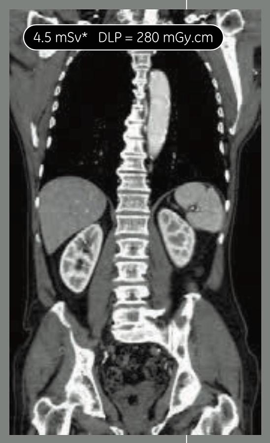 Reformado Tomografo General Electric Optima 660 de 64 cortes