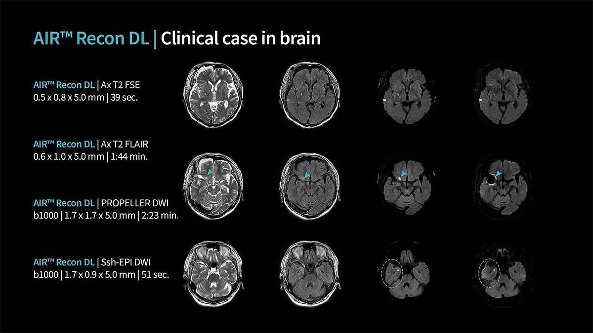 Refurbished 2019 General Electric (GE) Signa Explorer 1.5T