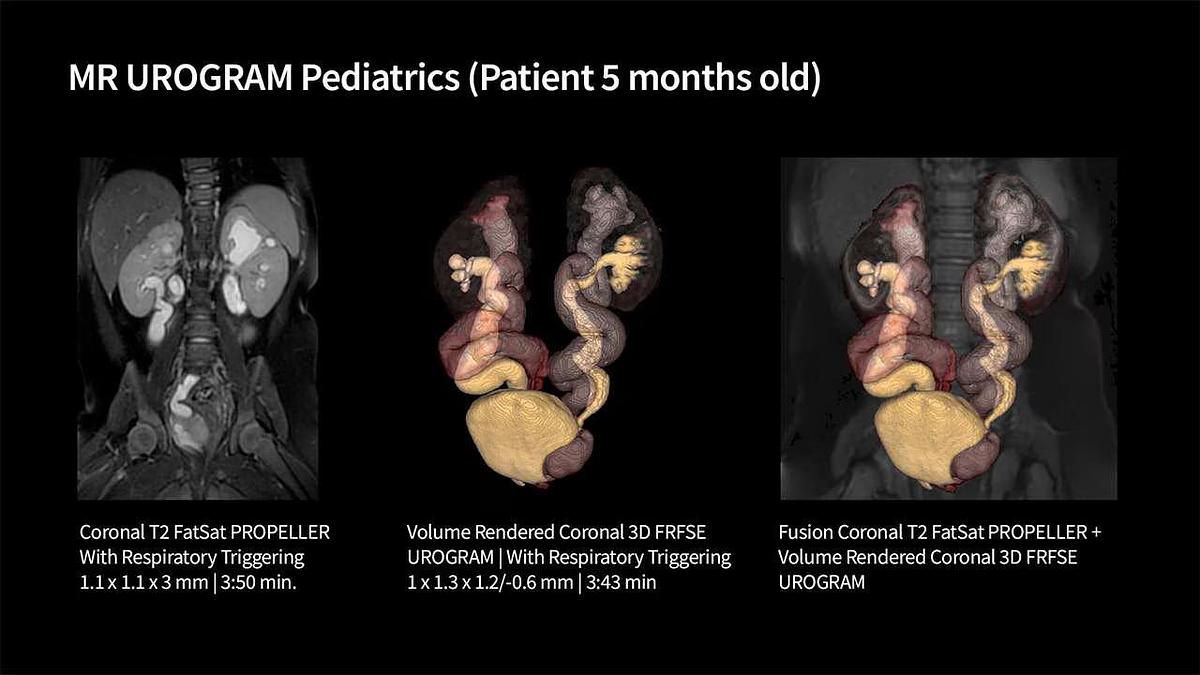 Refurbished 2019 General Electric (GE) Signa Explorer 1.5T