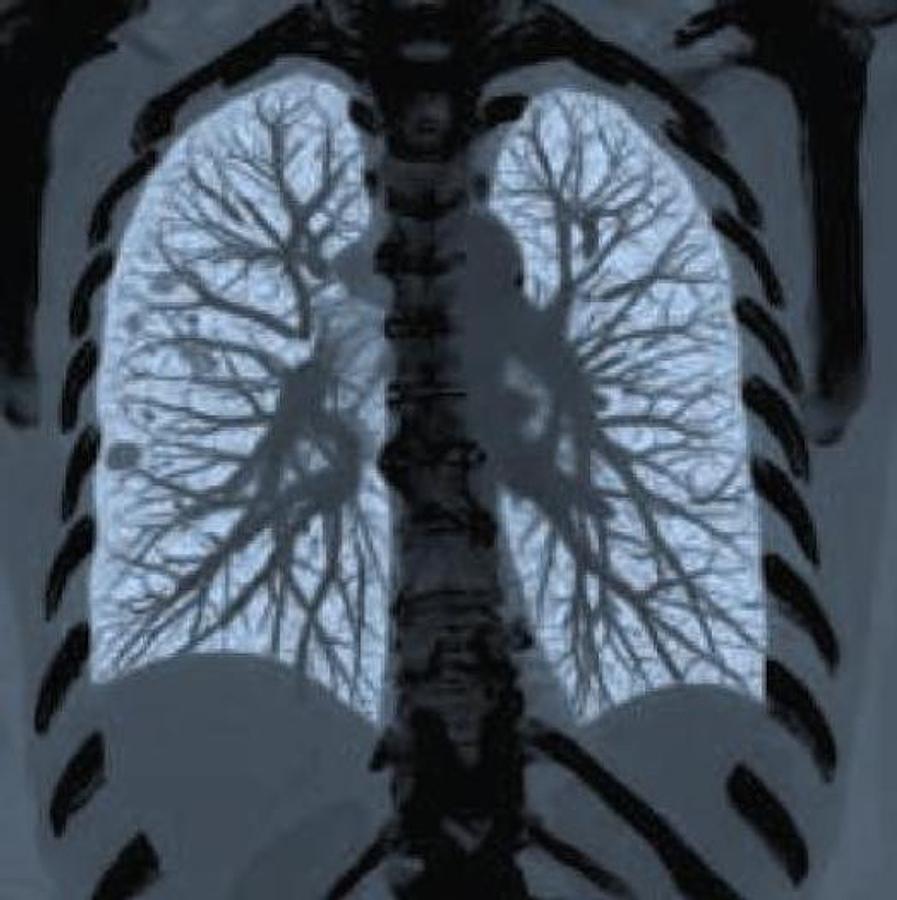 Refurbished General Electric (GE) LightSpeed VCT