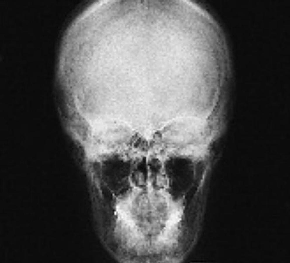 Usado 2001 General Electric (GE) Proteus Xr/a