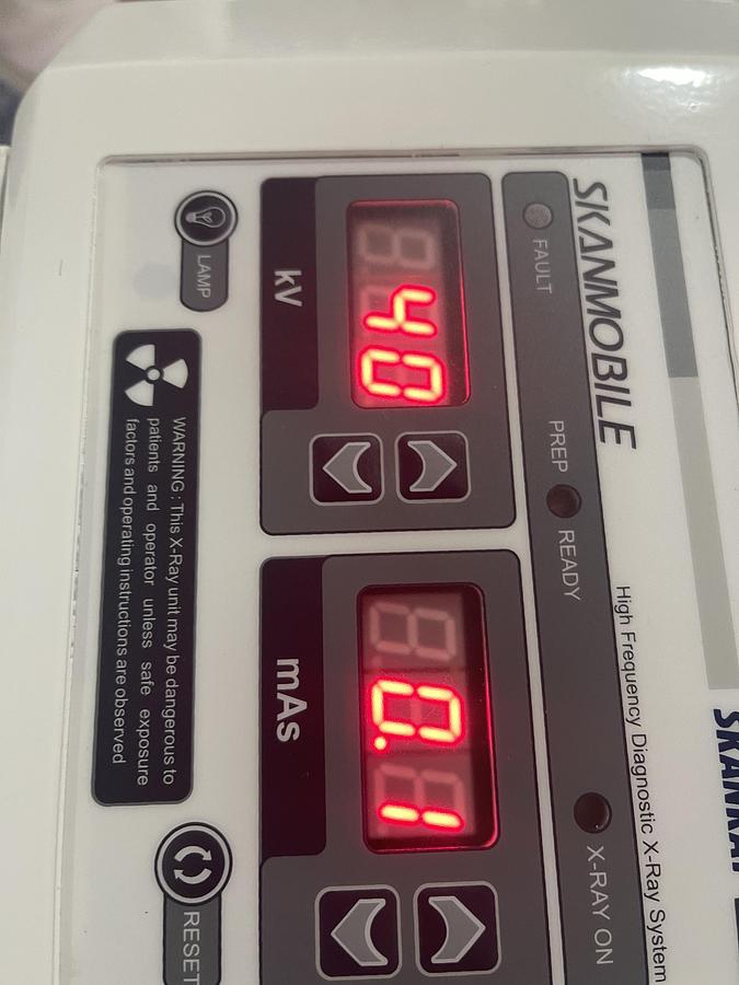 Rayos X portátil SKANRAY SKANMOBILE